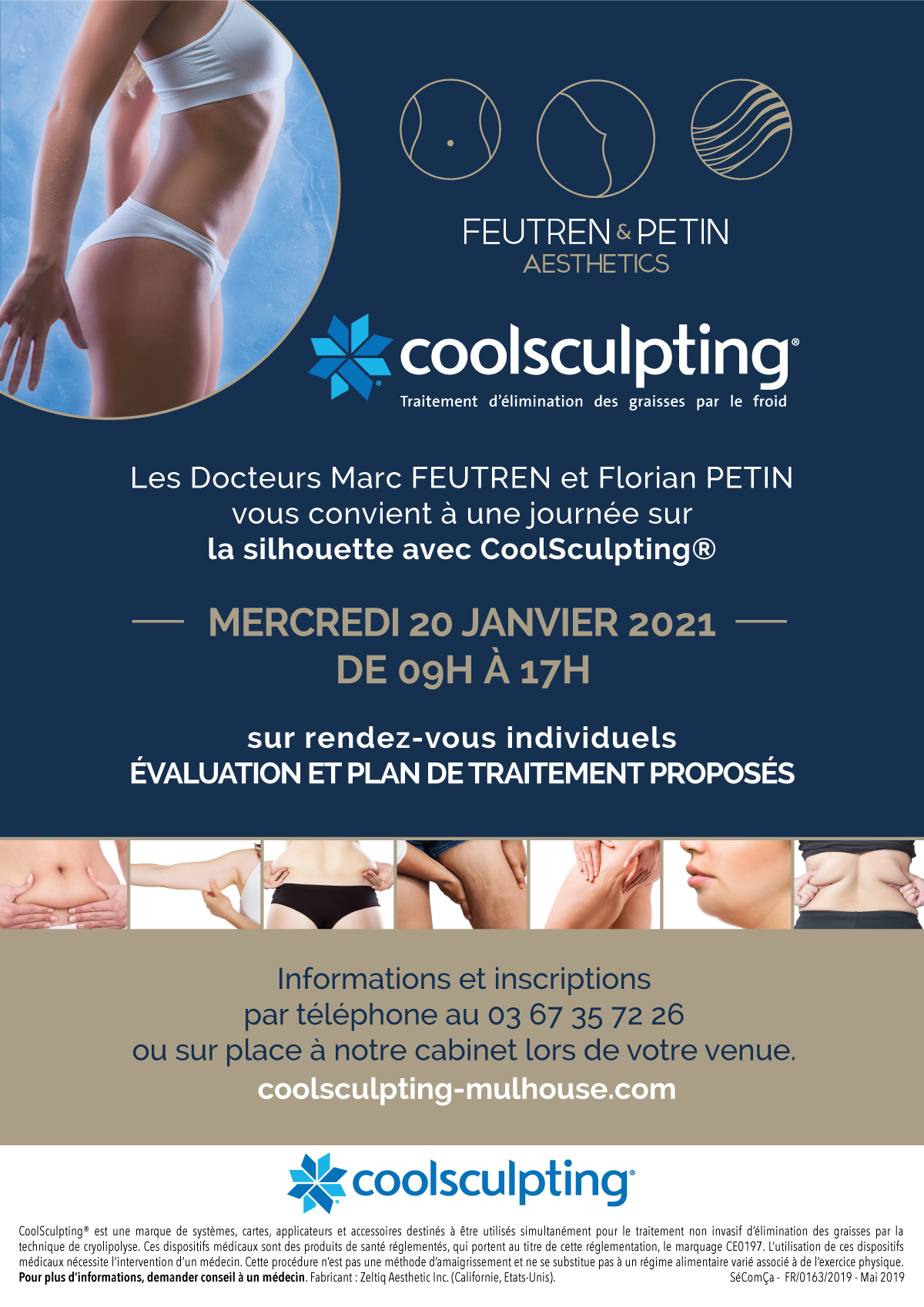 Evenement Coolsculpting le 20 janvier 2021 à Mulhouse Image